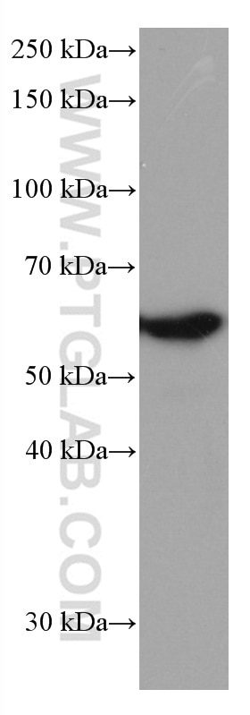 Western Blot (WB) analysis of NIH/3T3 cells using FYN Monoclonal antibody (66606-1-Ig)