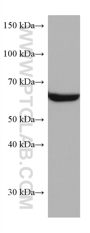 Western Blot (WB) analysis of Jurkat cells using FYN Monoclonal antibody (66606-1-Ig)