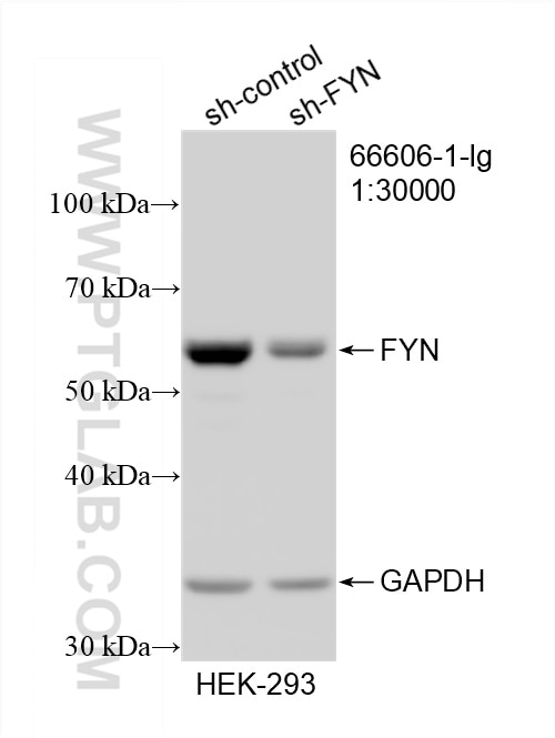 Western Blot (WB) analysis of HEK-293 cells using FYN Monoclonal antibody (66606-1-Ig)