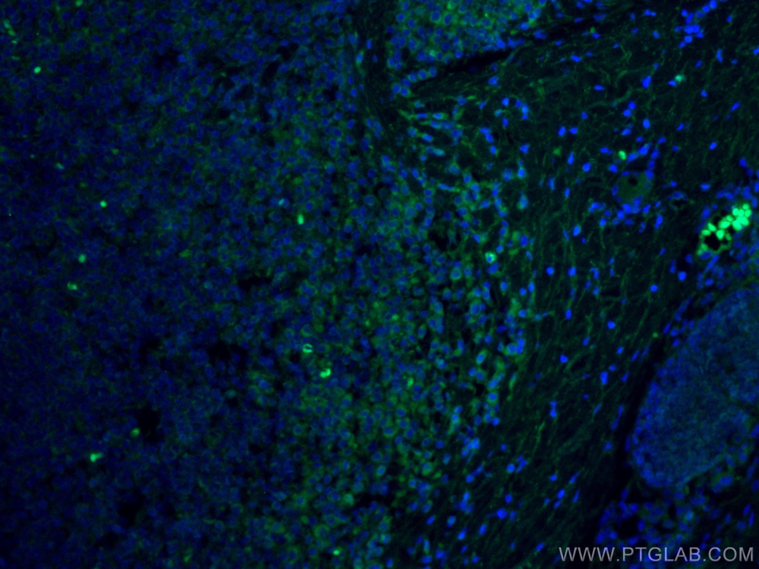 Immunofluorescence (IF) / fluorescent staining of human tonsillitis tissue using CoraLite® Plus 488-conjugated FYN Monoclonal antib (CL488-66606)
