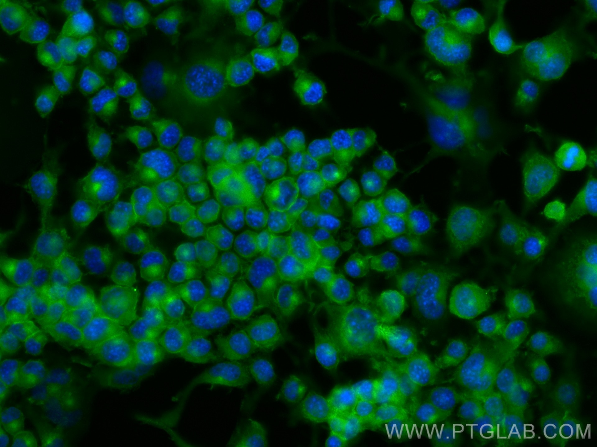 Immunofluorescence (IF) / fluorescent staining of Neuro-2a cells using CoraLite® Plus 488-conjugated FYN Monoclonal antib (CL488-66606)