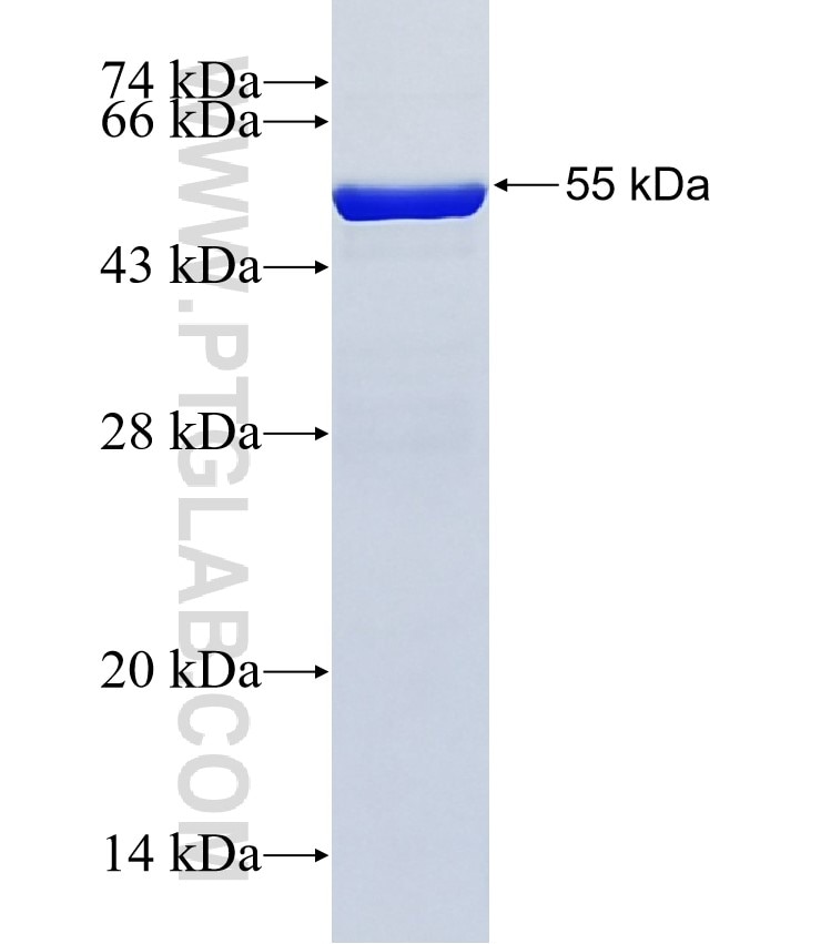 FYN fusion protein Ag11080 SDS-PAGE