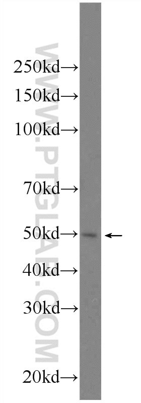 Western Blot (WB) analysis of HeLa cells using FYTTD1 Polyclonal antibody (24560-1-AP)