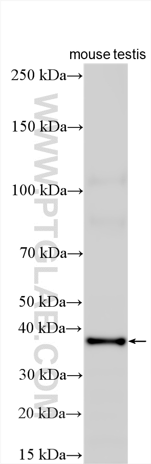 Western Blot (WB) analysis of various lysates using FYTTD1 Polyclonal antibody (24560-1-AP)