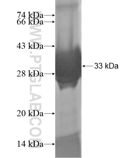 FYTTD1 fusion protein Ag20051 SDS-PAGE