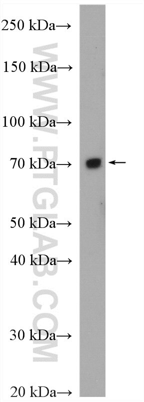 Western Blot (WB) analysis of HeLa cells using FZD1 Polyclonal antibody (28326-1-AP)