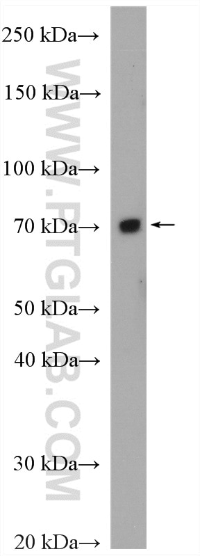 Western Blot (WB) analysis of HeLa cells using FZD1 Polyclonal antibody (28326-1-AP)