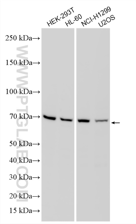 Western Blot (WB) analysis of various lysates using FZD1 Polyclonal antibody (28326-1-AP)