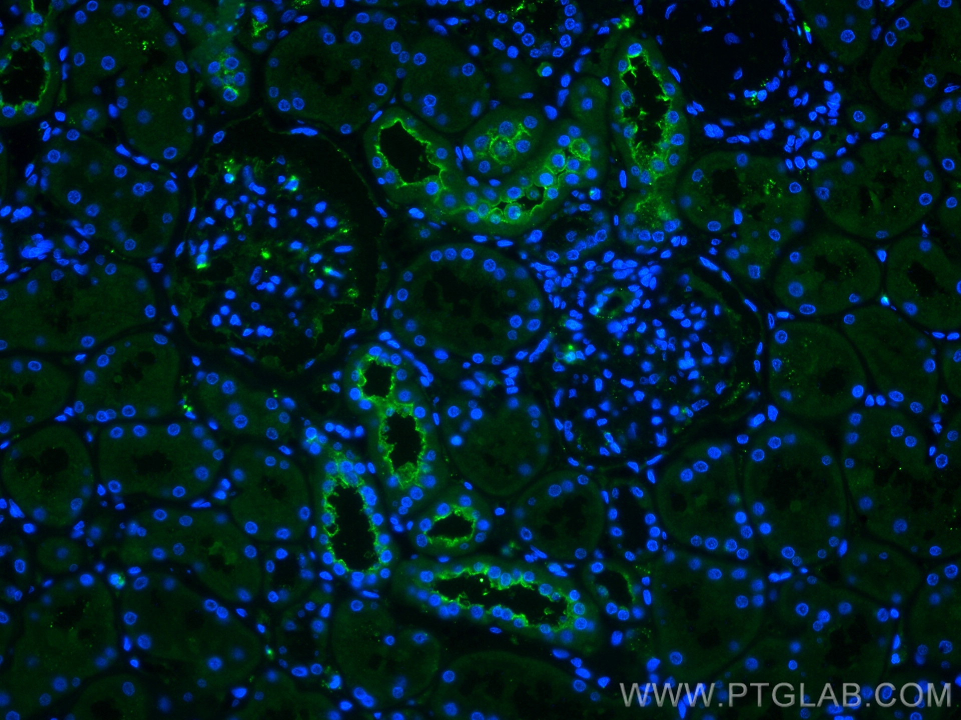 Immunofluorescence (IF) / fluorescent staining of human kidney tissue using Frizzled 10 Polyclonal antibody (18175-1-AP)