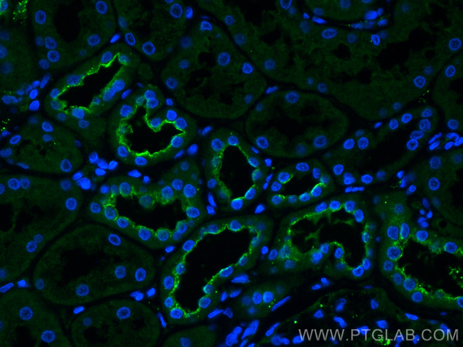 Immunofluorescence (IF) / fluorescent staining of human kidney tissue using Frizzled 10 Polyclonal antibody (18175-1-AP)