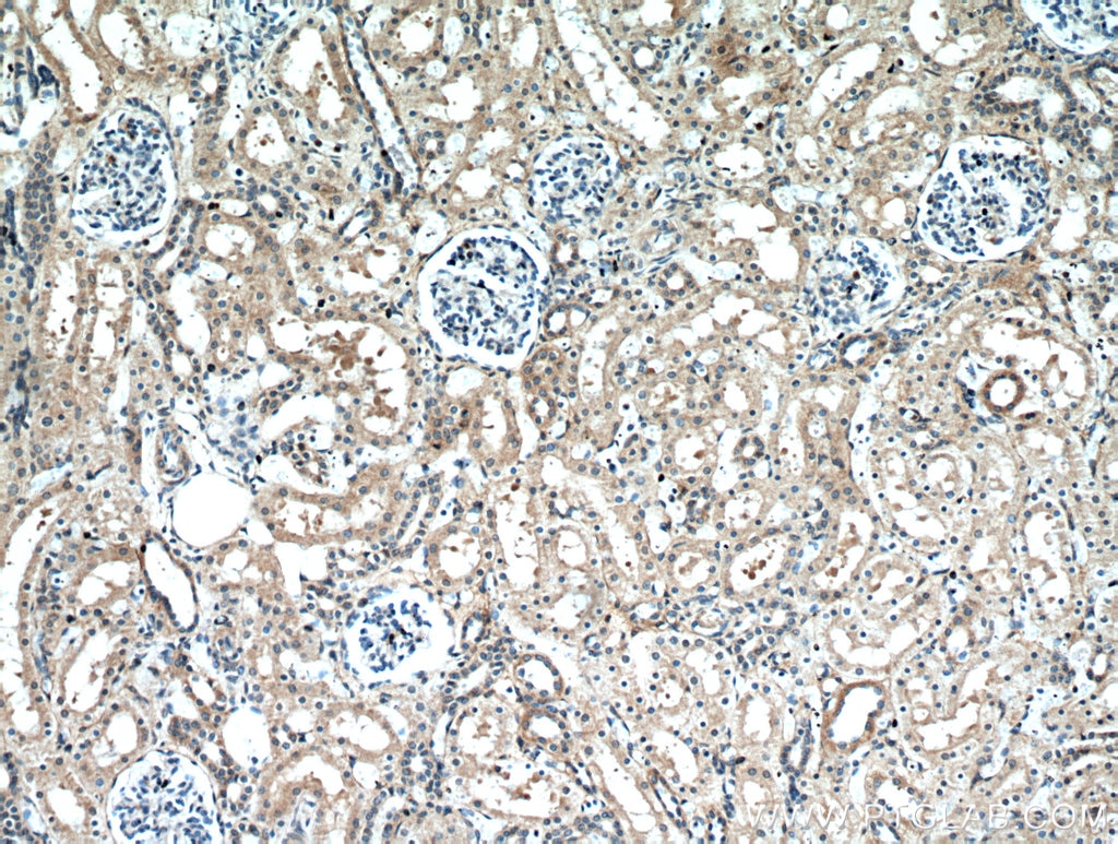 Immunohistochemistry (IHC) staining of human kidney tissue using Frizzled 10 Polyclonal antibody (18175-1-AP)