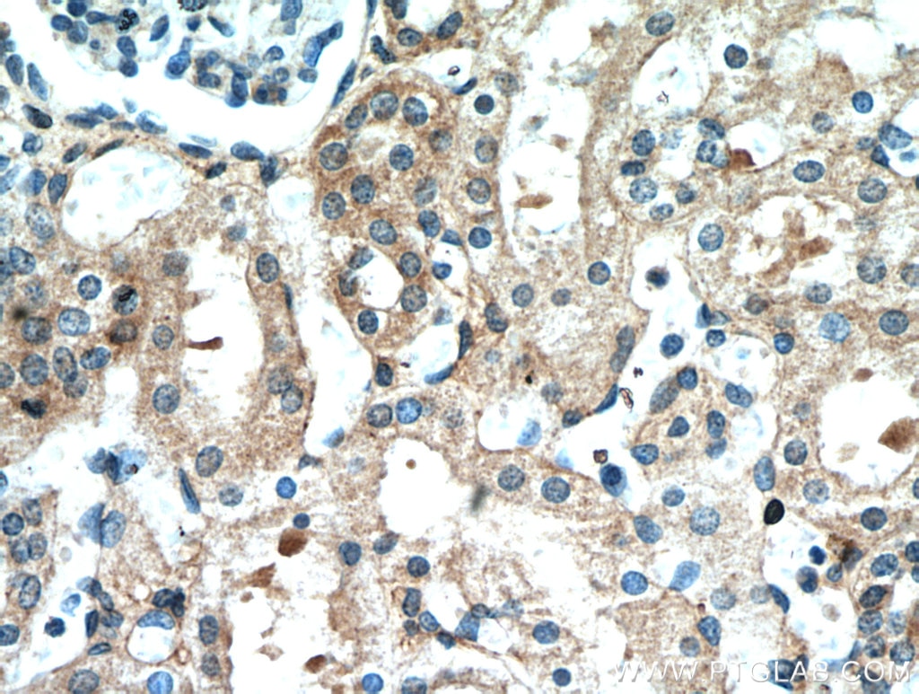 Immunohistochemistry (IHC) staining of human kidney tissue using Frizzled 10 Polyclonal antibody (18175-1-AP)