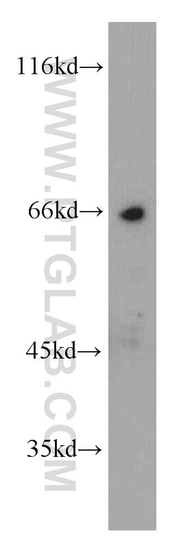 Western Blot (WB) analysis of HeLa cells using Frizzled 10 Polyclonal antibody (18175-1-AP)