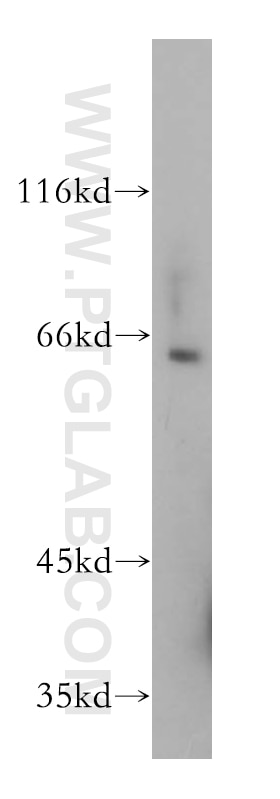Western Blot (WB) analysis of mouse kidney tissue using Frizzled 10 Polyclonal antibody (18175-1-AP)