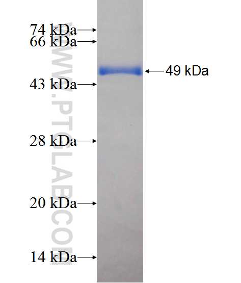 FZD10 fusion protein Ag12867 SDS-PAGE