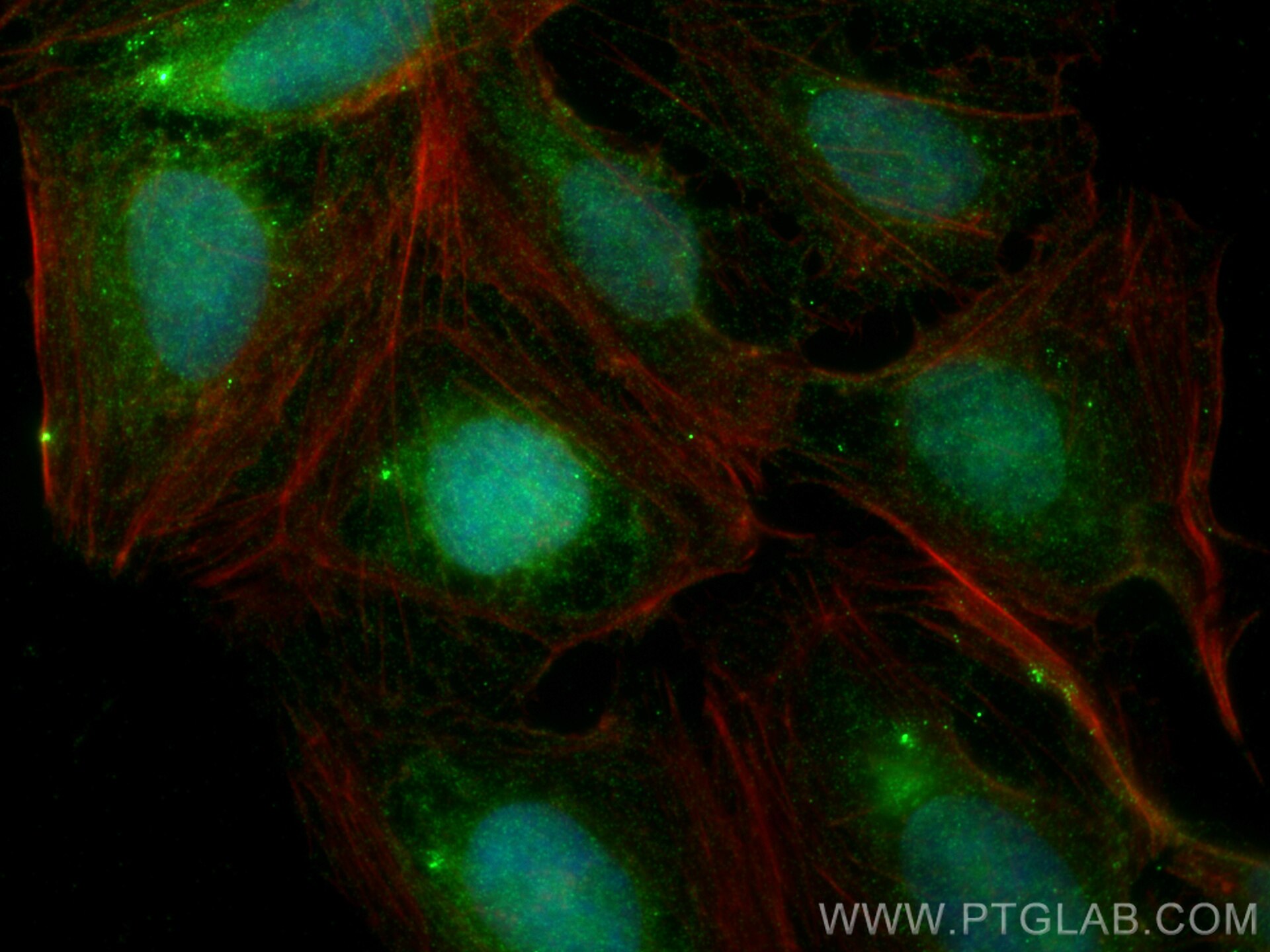 IF Staining of U2OS using 24272-1-AP