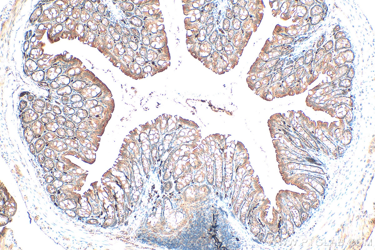 Immunohistochemistry (IHC) staining of mouse colon tissue using Frizzled 2 Polyclonal antibody (24272-1-AP)
