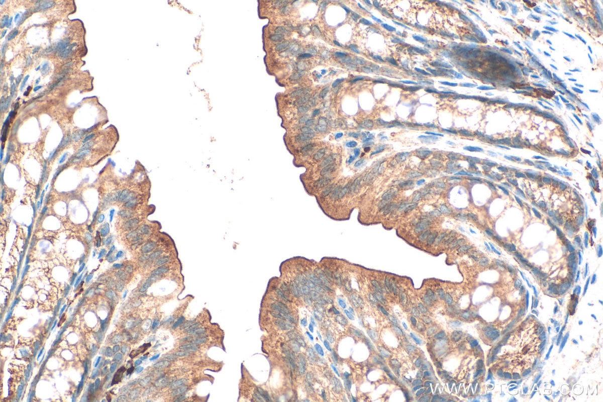Immunohistochemistry (IHC) staining of mouse colon tissue using Frizzled 2 Polyclonal antibody (24272-1-AP)
