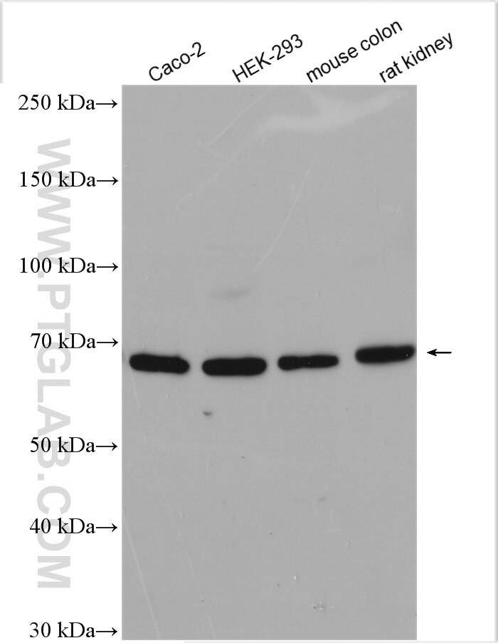 Western Blot (WB) analysis of various lysates using Frizzled 2 Polyclonal antibody (24272-1-AP)
