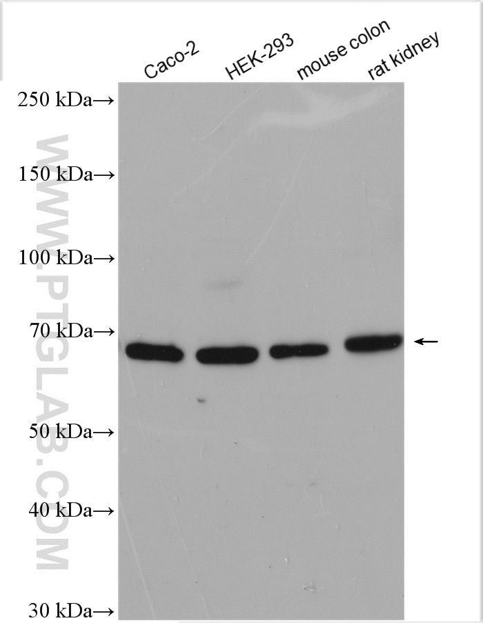 Western Blot (WB) analysis of various lysates using Frizzled 2 Polyclonal antibody (24272-1-AP)