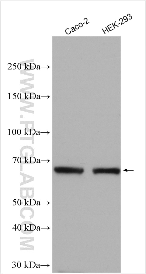 Western Blot (WB) analysis of various lysates using Frizzled 2 Polyclonal antibody (24272-1-AP)