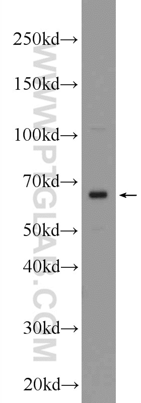 Western Blot (WB) analysis of mouse colon tissue using Frizzled 2 Polyclonal antibody (24272-1-AP)