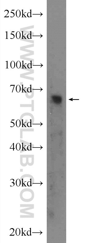 Western Blot (WB) analysis of rat kidney tissue using Frizzled 2 Polyclonal antibody (24272-1-AP)