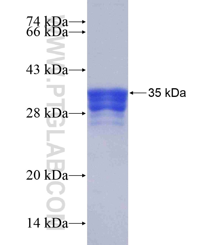 FZD2 fusion protein Ag18003 SDS-PAGE