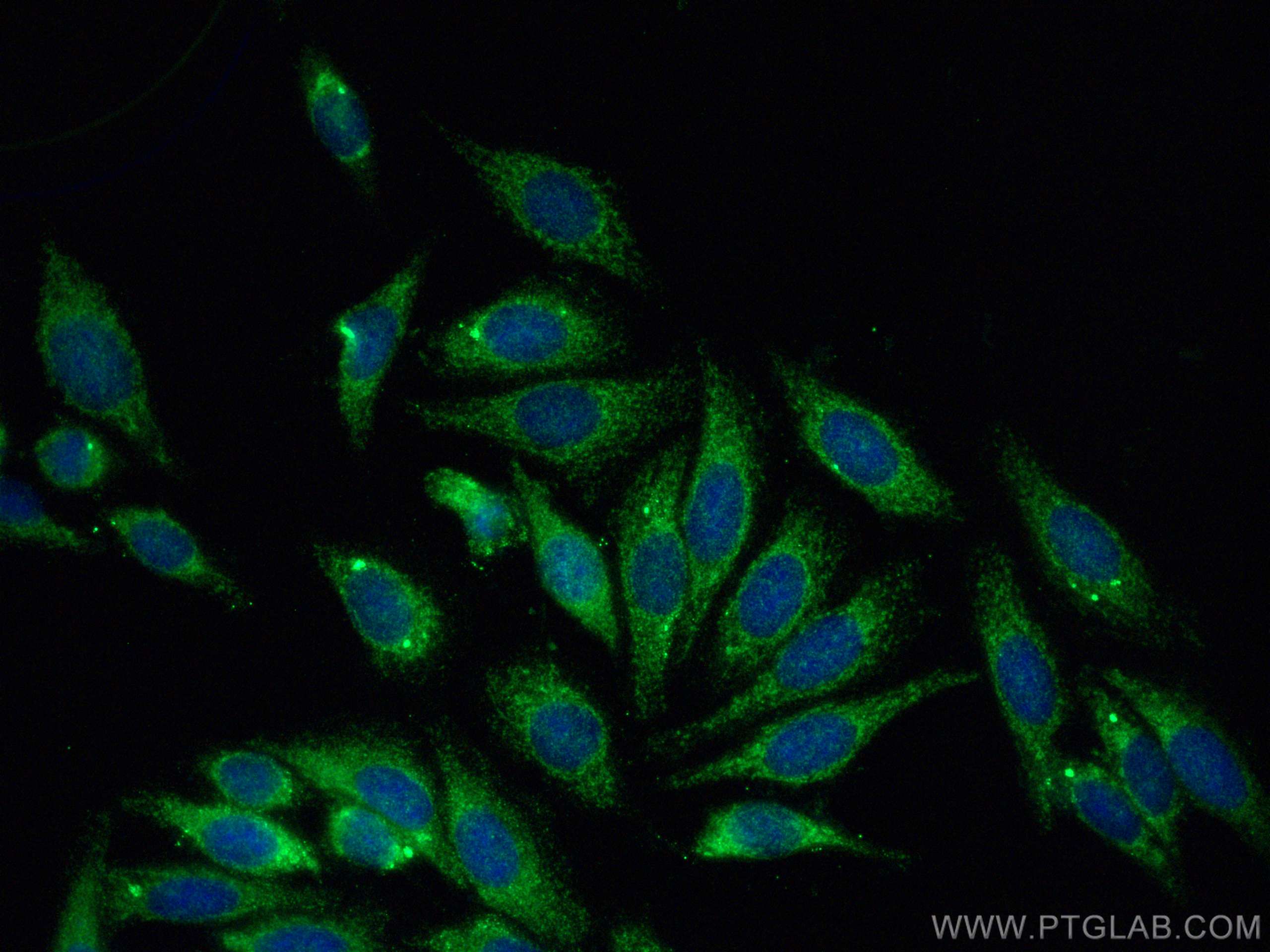 IF Staining of HepG2 using 21519-1-AP