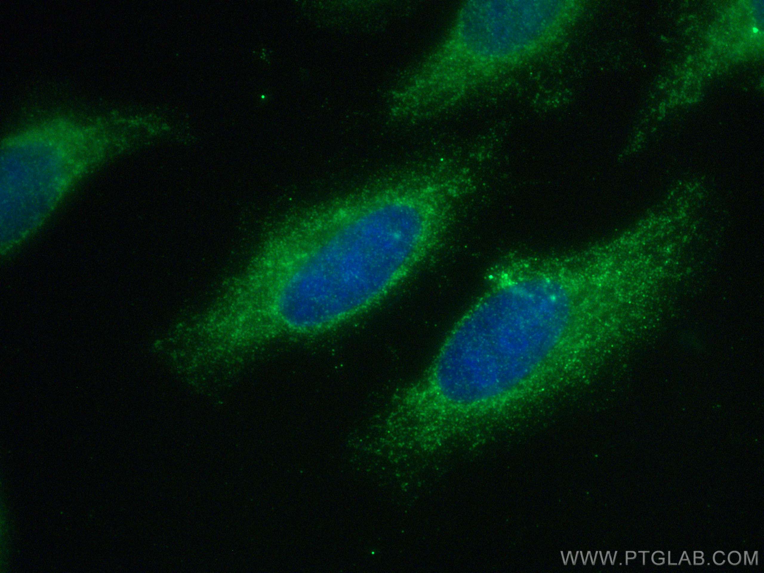 Immunofluorescence (IF) / fluorescent staining of HepG2 cells using Frizzled 5 Polyclonal antibody (21519-1-AP)