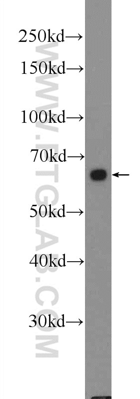 Western Blot (WB) analysis of COLO 320 cells using Frizzled 5 Polyclonal antibody (21519-1-AP)