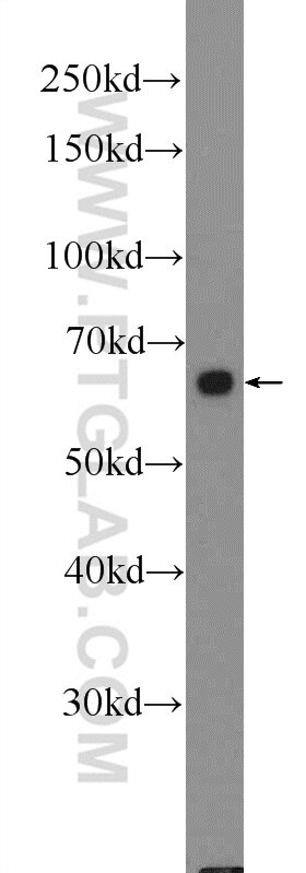 WB analysis of COLO 320 using 21519-1-AP