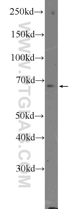 Western Blot (WB) analysis of PC-3 cells using Frizzled 5 Polyclonal antibody (21519-1-AP)