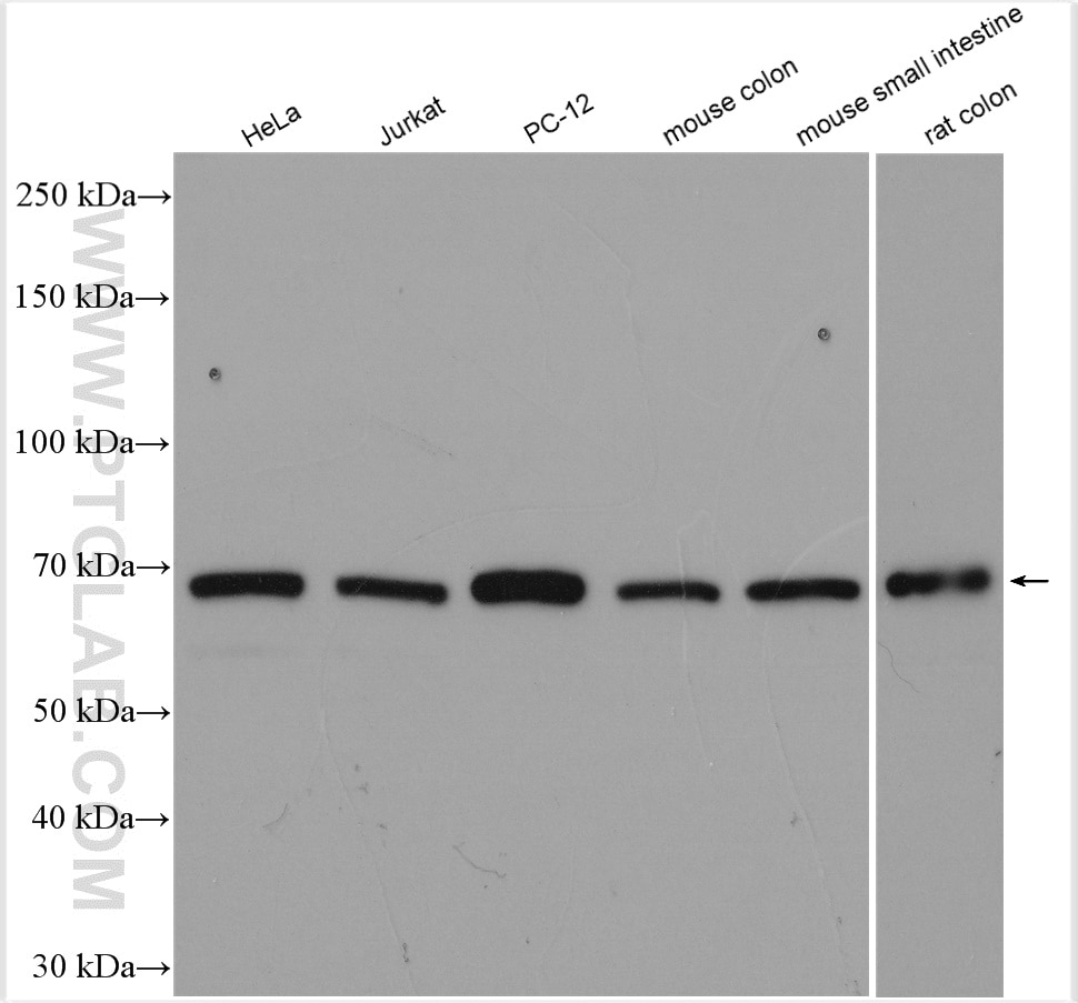 Western Blot (WB) analysis of various lysates using Frizzled 5 Polyclonal antibody (21519-1-AP)