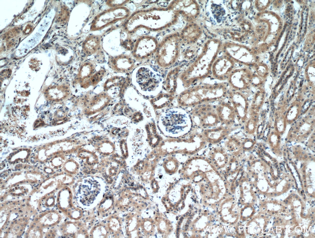 Immunohistochemistry (IHC) staining of human kidney tissue using FZD6 Polyclonal antibody (13982-1-AP)