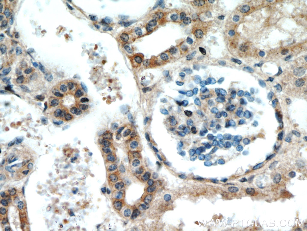 Immunohistochemistry (IHC) staining of human kidney tissue using FZD6 Polyclonal antibody (13982-1-AP)