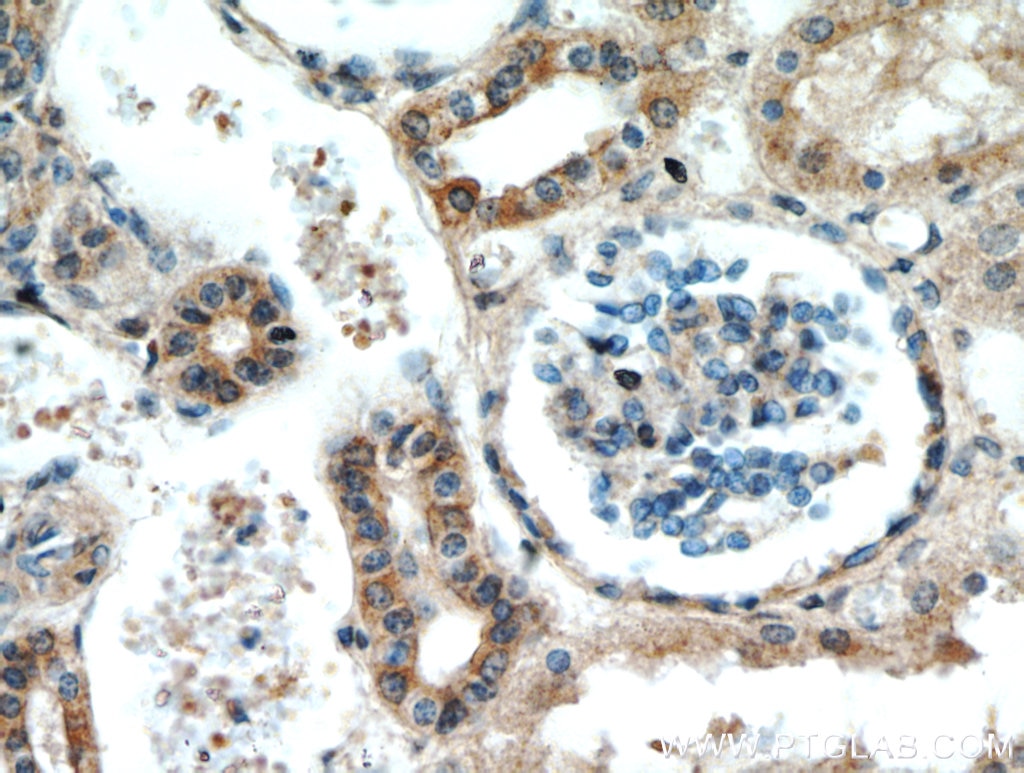 IHC staining of human kidney using 13982-1-AP