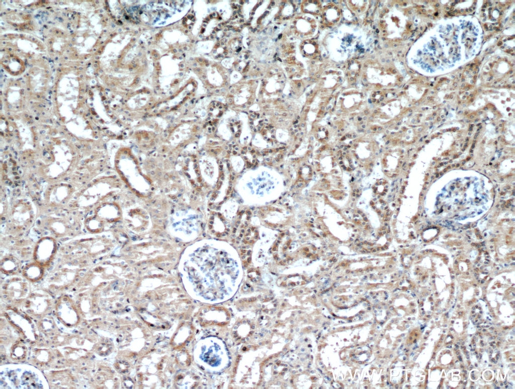 Immunohistochemistry (IHC) staining of human kidney tissue using FZD6 Polyclonal antibody (13982-1-AP)