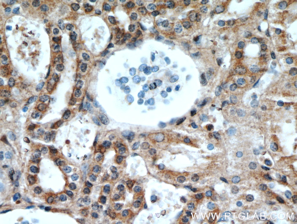 Immunohistochemistry (IHC) staining of human kidney tissue using FZD6 Polyclonal antibody (13982-1-AP)