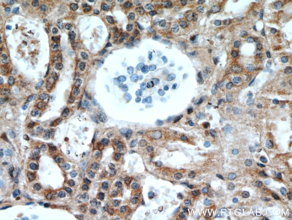 IHC staining of human kidney using 13982-1-AP