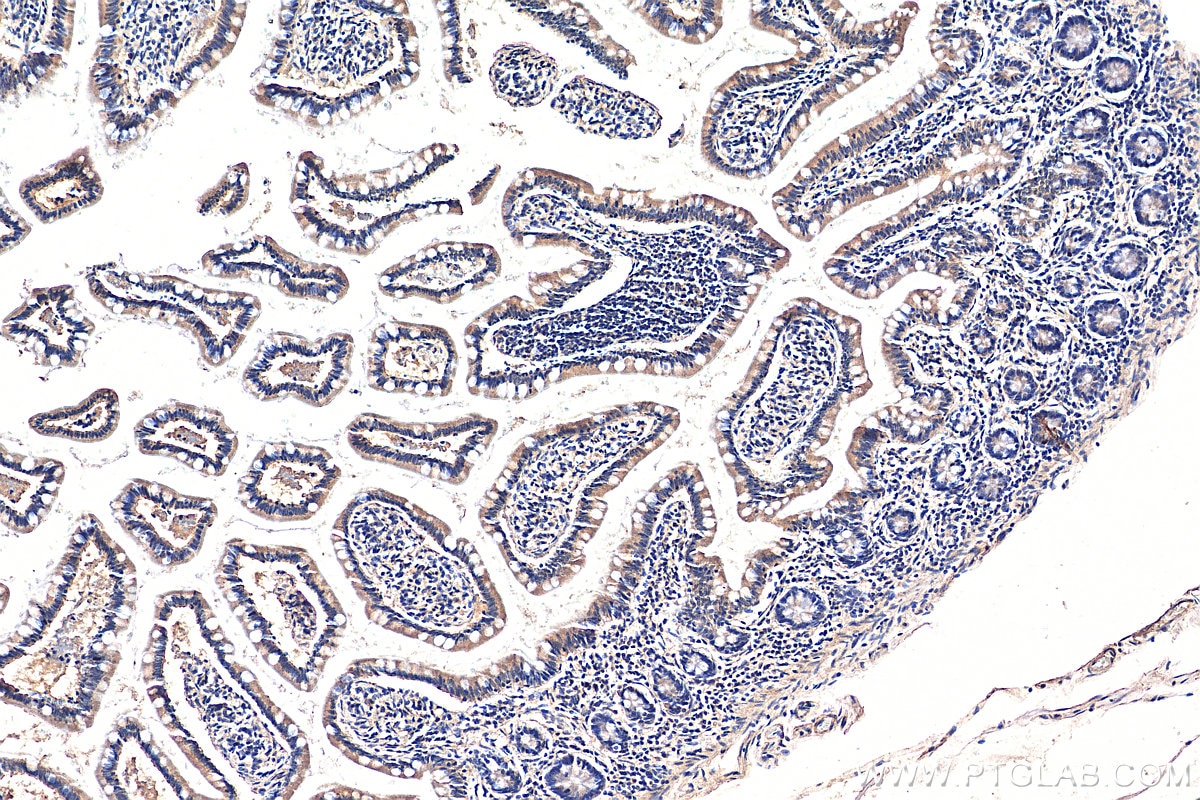 IHC staining of human small intestine using 16974-1-AP