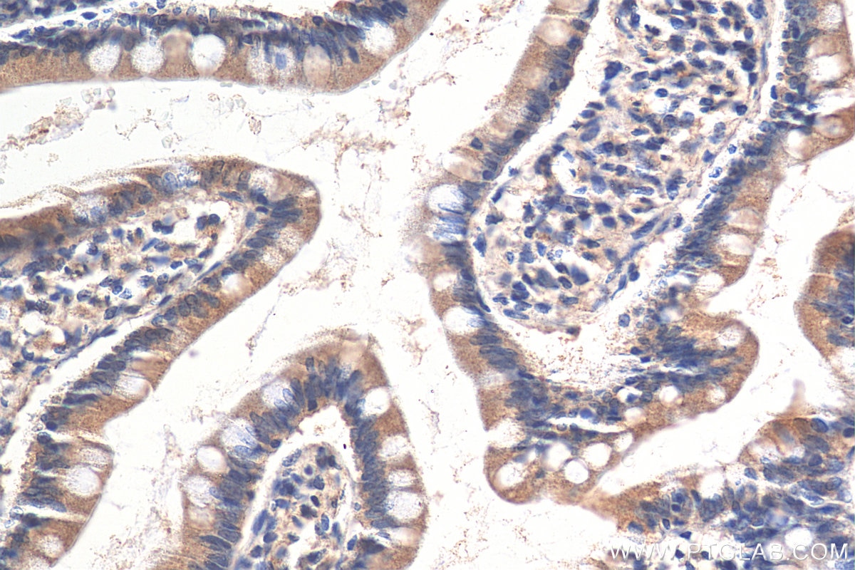 Immunohistochemistry (IHC) staining of human small intestine tissue using Frizzled 7 Polyclonal antibody (16974-1-AP)