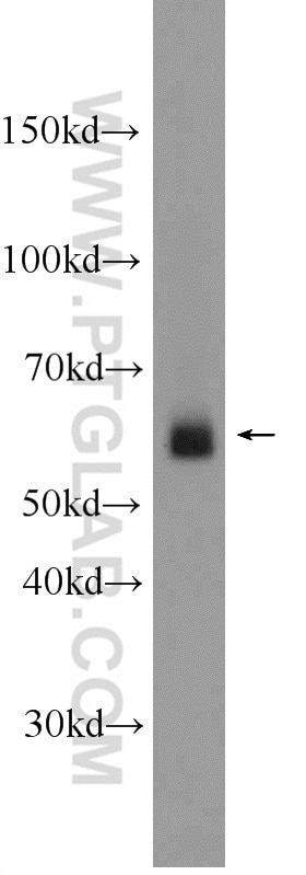 Western Blot (WB) analysis of mouse kidney tissue using Frizzled 7 Polyclonal antibody (16974-1-AP)
