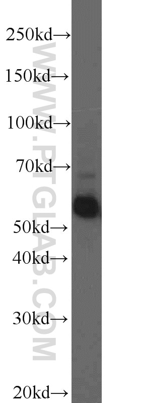 Western Blot (WB) analysis of mouse heart tissue using Frizzled 7 Polyclonal antibody (16974-1-AP)