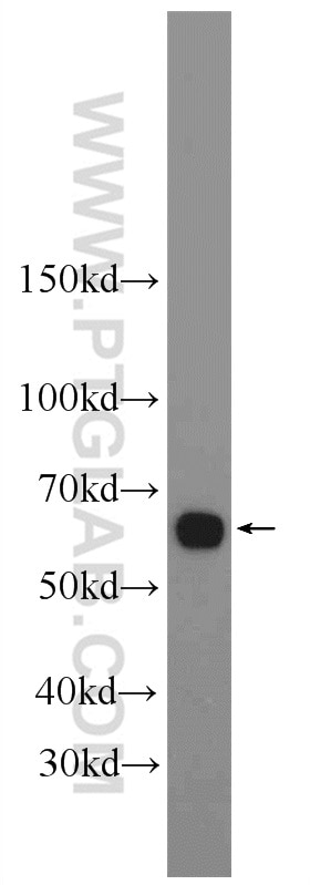 Western Blot (WB) analysis of mouse skeletal muscle tissue using Frizzled 7 Polyclonal antibody (16974-1-AP)