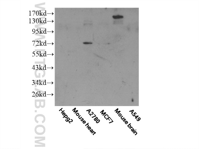 Western Blot (WB) analysis of multi-cells/tissue using Frizzled 8 Polyclonal antibody (55093-1-AP)