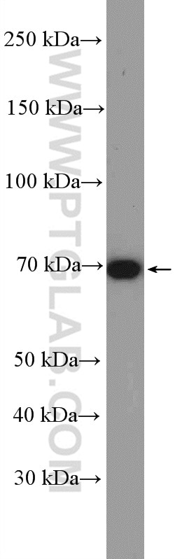 Western Blot (WB) analysis of HeLa cells using Frizzled 8 Polyclonal antibody (55093-1-AP)