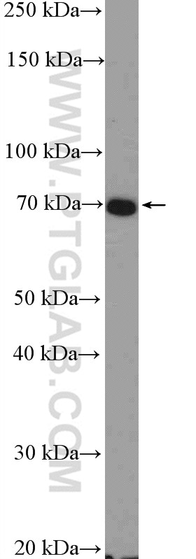 Western Blot (WB) analysis of mouse embryo tissue using Frizzled 8 Polyclonal antibody (55093-1-AP)