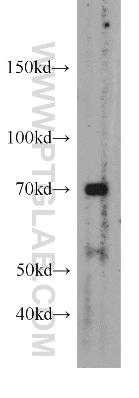 WB analysis of mouse lung using 55093-1-AP