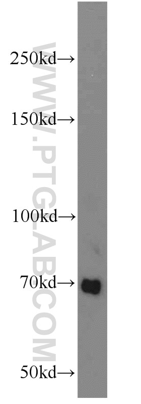 Western Blot (WB) analysis of mouse heart tissue using Frizzled 8 Polyclonal antibody (55093-1-AP)